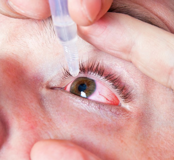 doh-issues-tips-to-prevent-sore-eyes-philippine-canadian-inquirer