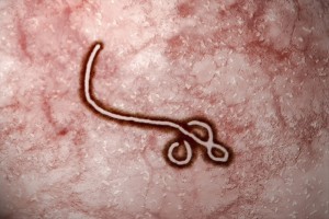 Ebola virus (Shutterstock photo)