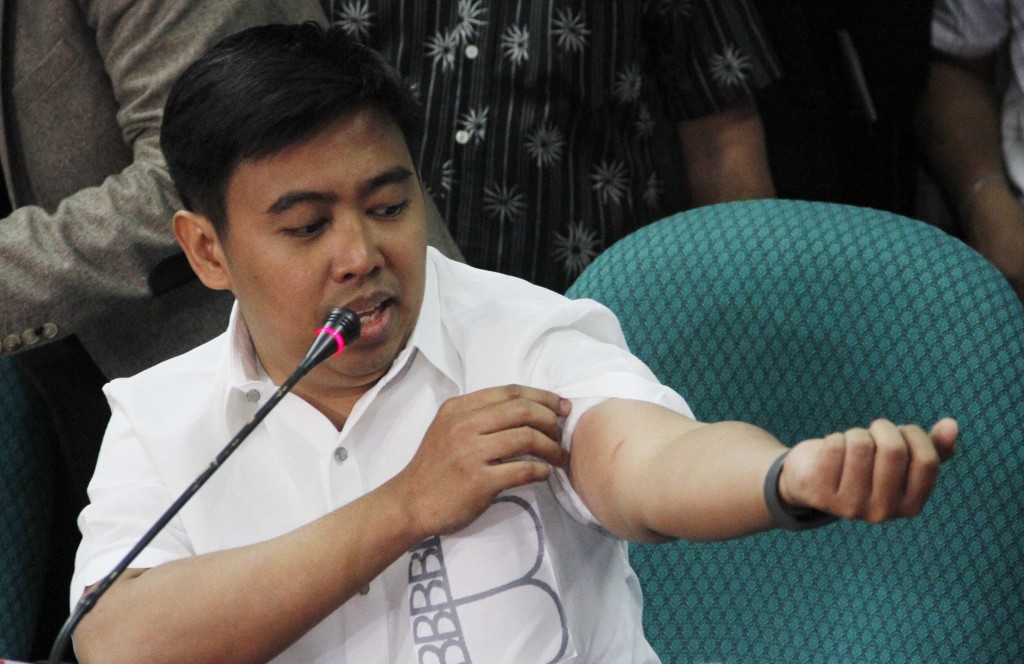 Makati Mayor Erwin Binay show a minor bruise and pacifies supporters after he was brought to the Senate plenary when he refused to testify at the Senate hearing on Thursday (January 29, 2015) at the Senate Building in Pasay City. (PNA photo by Avito C. Dalan)