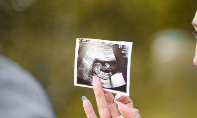 person holding an ultrasound picture