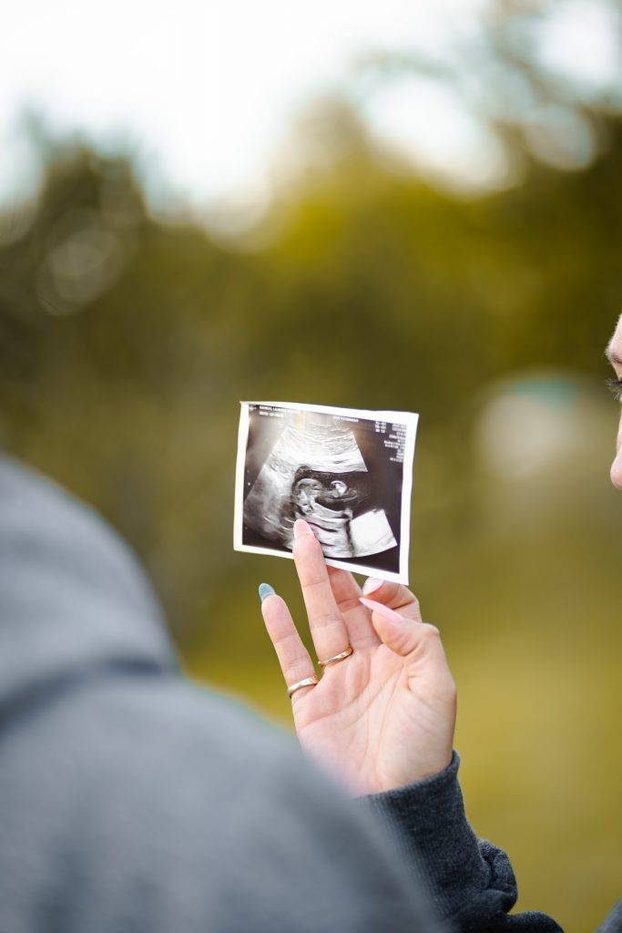 person holding an ultrasound picture