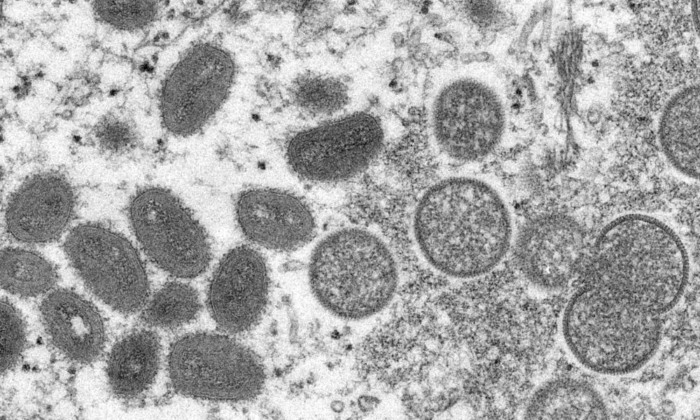 Microscope image of monkeypox
