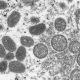 Microscope image of monkeypox