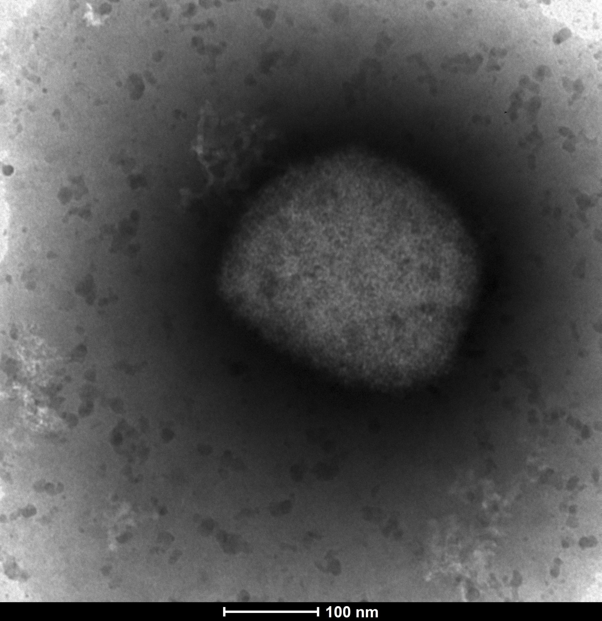Electronic microscope image of monkeypox virus