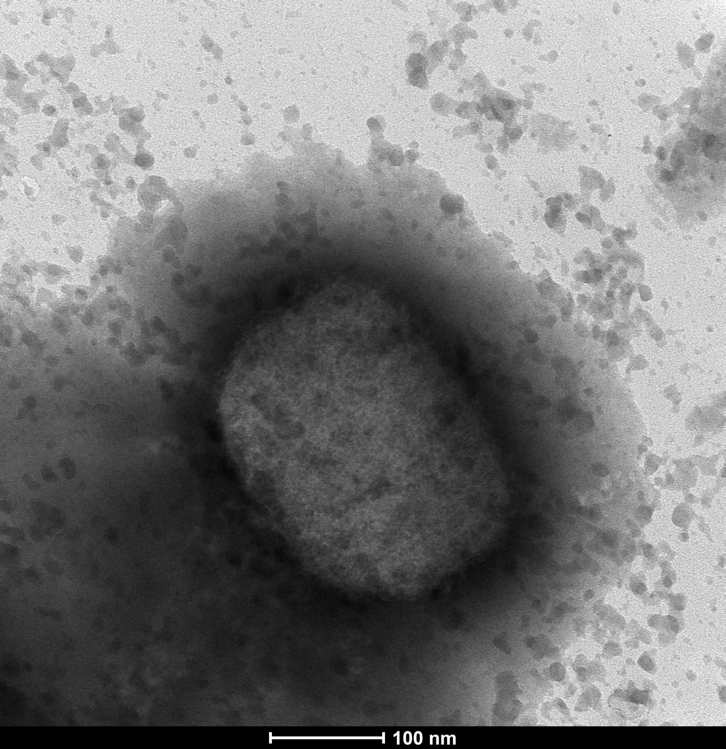 electronic microscope image of monkeypox virus