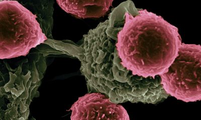 cells