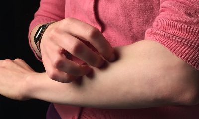 scratching arm
