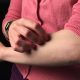 scratching arm