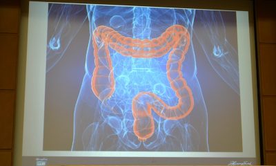 graphic image of colon seen on screen