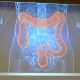 graphic image of colon seen on screen
