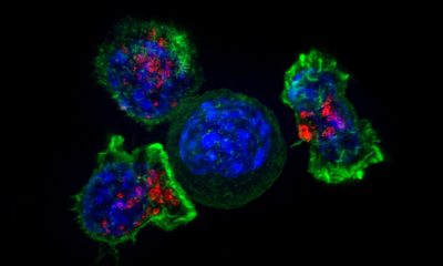 Killer T cells surround a cancer cell