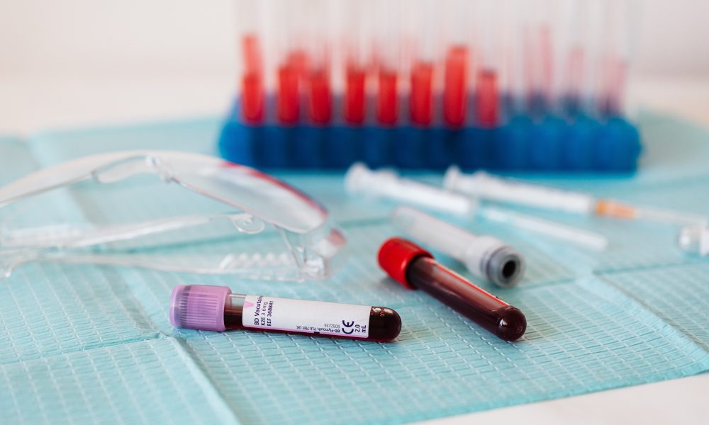 Full vials of blood near various medical equipment for taking blood