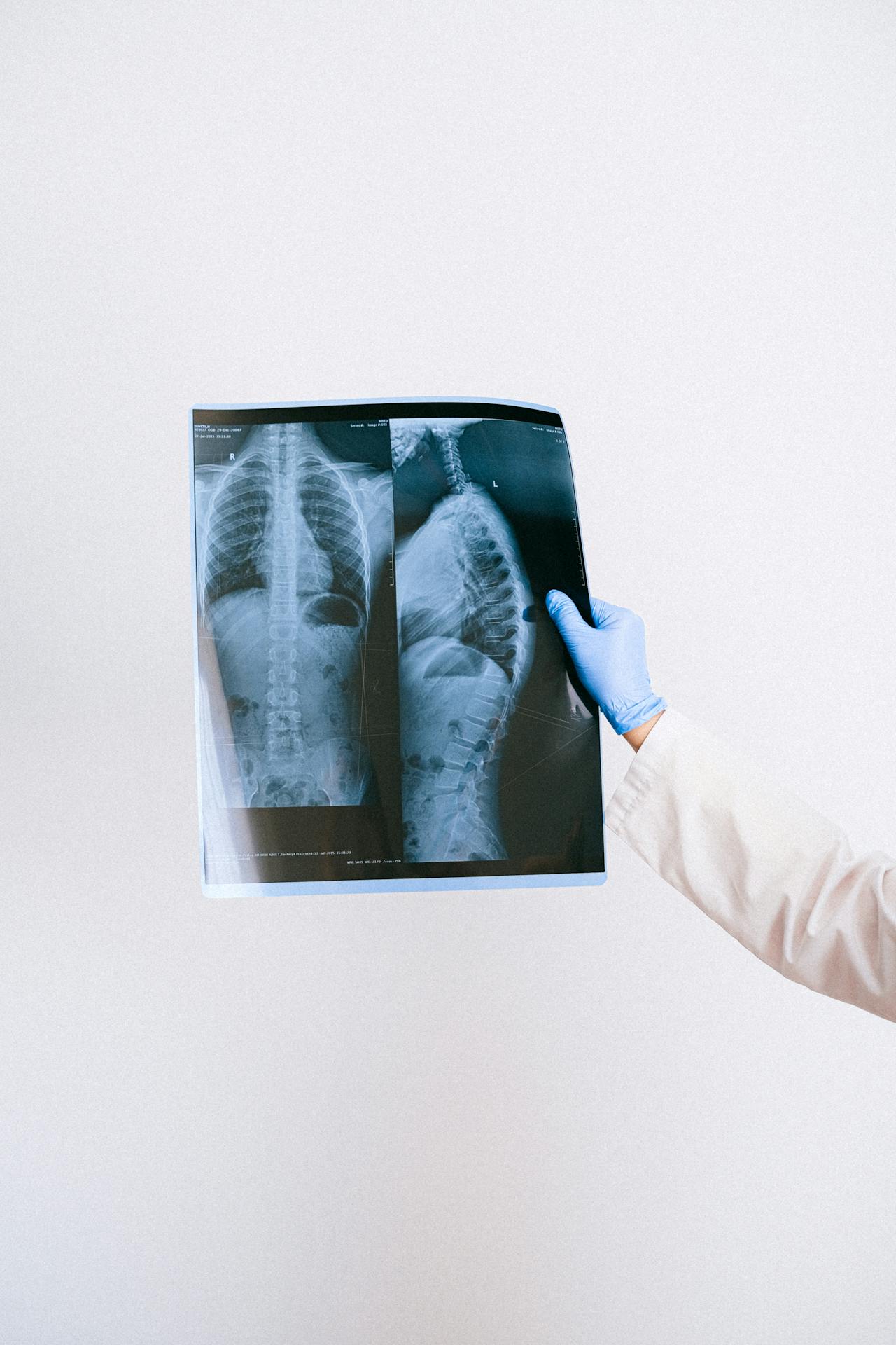 A medical worker examines an X-ray of a patient’s lungs.