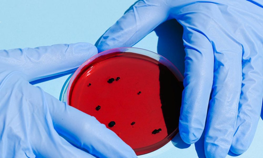 person holding petri dish